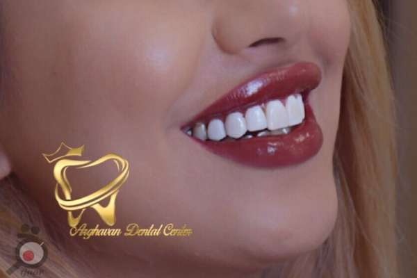 طرح تخفیفات دندانپزشکی از تولد تا تولد به مناسبت دهه کرامت طرح تخفیفات دندانپزشکی از تولد تا تولد به مناسبت دهه کرامت