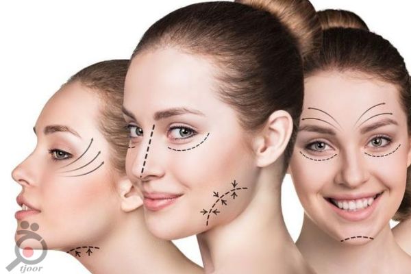 تخفیف ویژه رفع چروک دور چشم و جوانسازی دور چشم