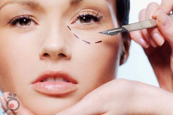 جشنواره تابستانی کلینیک آریا