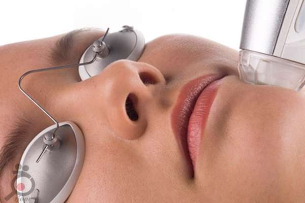 تخفیف ویژه خدمات لیزر موهای زائد