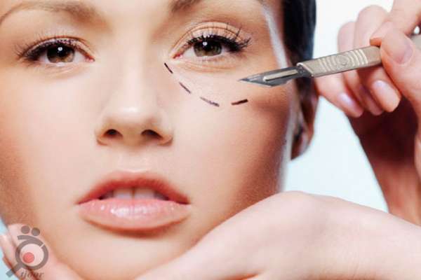 تخفیف ویژه بوتاکس و تزریق ژل زیر چشم