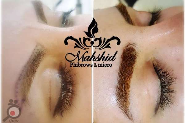 تخفیف ویژه میکرودرم ، میکروپیگمنتیشن ، میکروبلیدینگ به مناسبت افتتاحیه سالن