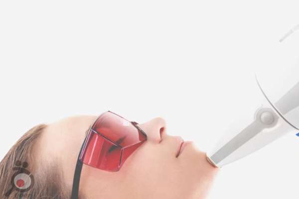 تخفیف خدمات لیزر موهای زائد