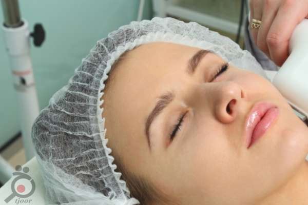 تخفیف استثنائی پکیج لیزر موهای زائد