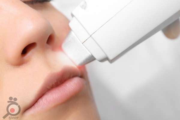 جشنواره لیزر موهای زائد در کلینیک سیب سبز جشنواره لیزر موهای زائد در کلینیک سیب سبز