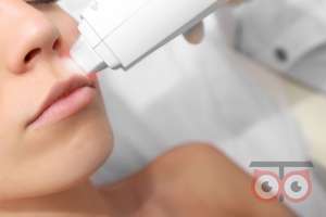 تخفیف ویژه لیزر موهای زائد تخفیف ویژه لیزر موهای زائد