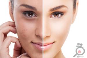 تخفیف ویژه بمناسبت پنجمین سالگرد کلینیک تخفیف ویژه بمناسبت پنجمین سالگرد کلینیک