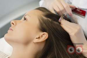 تخفیف ویژه مزوتراپی موی سر تخفیف ویژه مزوتراپی موی سر