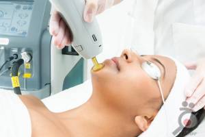 تخفیف ویژه لیزر بانوان تخفیف ویژه لیزر بانوان