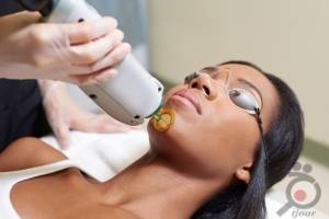 تخفیف ویژه لیزر بانوان تخفیف ویژه لیزر بانوان