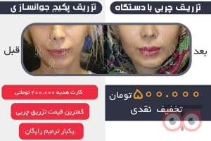 تخفیف ویژه تزریق چربی تخفیف ویژه تزریق چربی