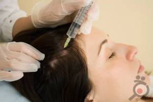 تخفیف ویژه مزوتراپی تخفیف ویژه مزوتراپی