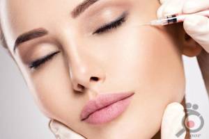 تخفیف ویژه ژل و بوتاکس تخفیف ویژه ژل و بوتاکس