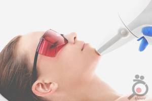 تخفیف ویژه لیزر تخفیف ویژه لیزر