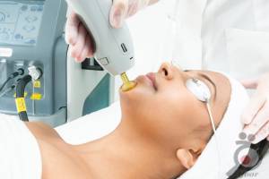 تخفیف ویژه لیزر تخفیف ویژه لیزر