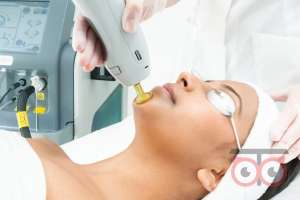 تخفیف ویژه لیزر تخفیف ویژه لیزر