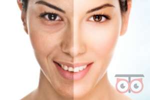 تخفیف ویژه لیزر CO2 تخفیف ویژه لیزر CO2