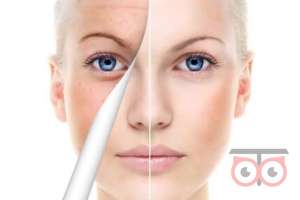 تخفیف ویژه لیزر CO2 تخفیف ویژه لیزر CO2