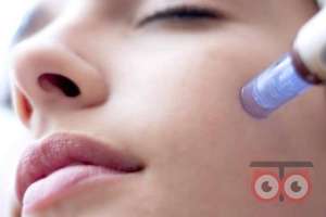 تخفیف ویژه میکرونیدلینگ تخفیف ویژه میکرونیدلینگ