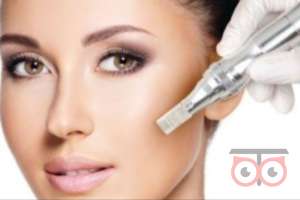 تخفیف ویژه میکرونیدلینگ تخفیف ویژه میکرونیدلینگ