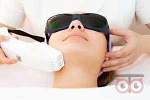 تخفیف ویژه لیزر موهای زائد تخفیف ویژه لیزر موهای زائد