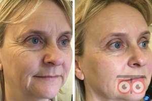 تخفیف پاییزی تمام خدمات تخفیف پاییزی تمام خدمات