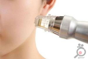 پکیج 3 جلسه ای آر اف صورت پکیج 3 جلسه ای آر اف صورت