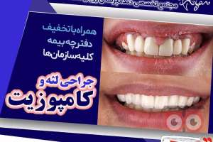 تخفیف ویژه ایمپلنت دندان تخفیف ویژه ایمپلنت دندان