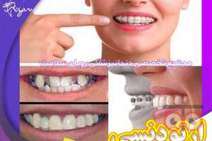 تخفیف ویژه ارتودنسی تخفیف ویژه ارتودنسی