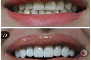 تخفیف ویژه پاییزی تخفیف ویژه پاییزی