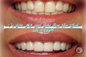 تخفیف ویژه پاییزی تخفیف ویژه پاییزی