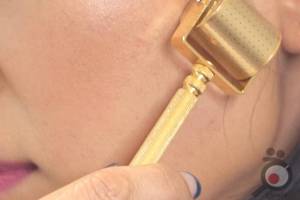 تخفیف ویژه میکرونیدلینگ تخفیف ویژه میکرونیدلینگ