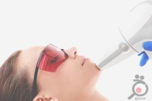 تخفیف ویژه لیزر تخفیف ویژه لیزر