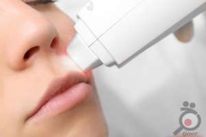 تخفیف ویژه لیزر تخفیف ویژه لیزر