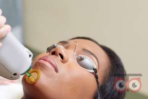 تخفیف باور نکردنی لیزرالکساندرایت اپوجی پلاس تخفیف باور نکردنی لیزرالکساندرایت اپوجی پلاس