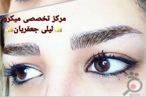 تخفیف میکروپیگمنتیشن تخفیف میکروپیگمنتیشن