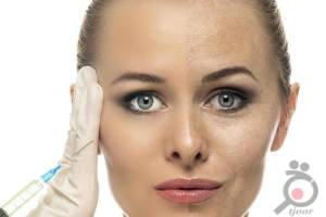 جشنواره تزریق ژل لب جشنواره تزریق ژل لب