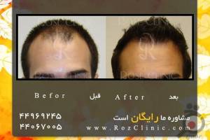 تخفیف ویژه خدمات تخفیف ویژه خدمات