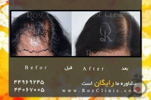 تخفیف ویژه خدمات تخفیف ویژه خدمات