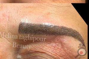 تخفیف ویژه انجام میکروپیگمنتیشن ابرو تخفیف ویژه انجام میکروپیگمنتیشن ابرو