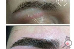 تخفیف یلدایی بر روی تمام لاین های زیبایی تخفیف یلدایی بر روی تمام لاین های زیبایی