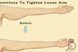 تخفیف رفع افتادگی شکم و بازو تخفیف رفع افتادگی شکم و بازو