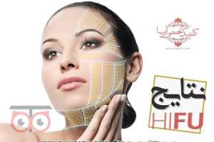 جشنواره خدمات زیبایی کلینیک تخصصی آریا در ماه مبارک رمضان جشنواره خدمات زیبایی کلینیک تخصصی آریا در ماه مبارک رمضان