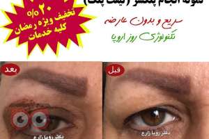 تخفیفات ویژه ماه مبارک رمضان در کلینیک زیبایی لوتوس زیر نظر دکتر رویا زارع تخفیفات ویژه ماه مبارک رمضان در کلینیک زیبایی لوتوس زیر نظر دکتر رویا زارع