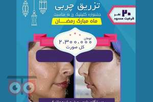 تخفیفات ویژه کلینیک رز به مناسبت ماه مبارک رمضان تخفیفات ویژه کلینیک رز به مناسبت ماه مبارک رمضان