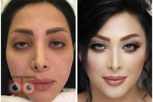 آفر ویژه فردا برای قرار داد حضوری در بازدید عروسهای لیلی رضایی آفر ویژه فردا برای قرار داد حضوری در بازدید عروسهای لیلی رضایی