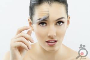 تخفیف ویژه بوتاکس تخفیف ویژه بوتاکس