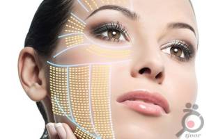 تخفیف ویژه هایفوتراپی تخفیف ویژه هایفوتراپی