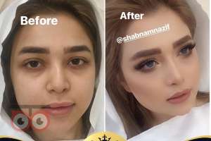 بازدید عروس همراه با آفر ویژه قرارداد به مناسبت عید تا عید بازدید عروس همراه با آفر ویژه قرارداد به مناسبت عید تا عید