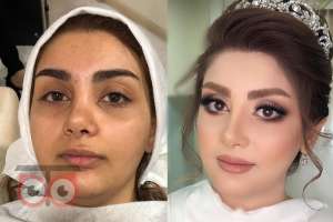 بازدید عروس همراه با آفر ویژه قرارداد بازدید عروس همراه با آفر ویژه قرارداد